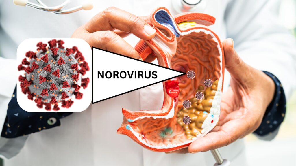 ORBIVIBE - NOROVIRUS